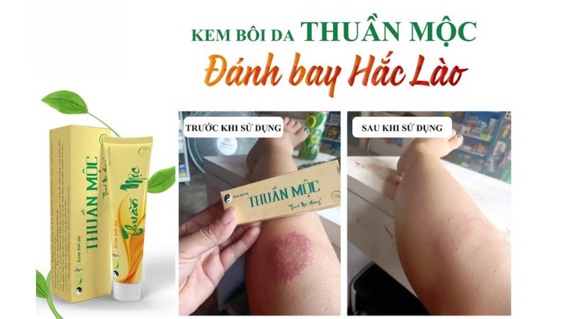 Làn da mất nước nhanh chóng, khiến bề mặt da trở nên sần sùi, bong tróc, thậm chí nứt nẻ