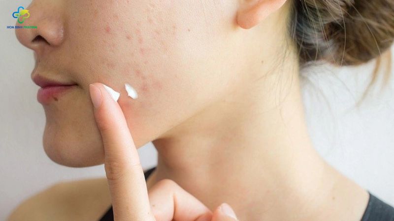 Nếu bạn thường xuyên bị mụn nhọt ở cùng một vị trí hoặc vừa khỏi mụn lại tái phát liên tục, rất có thể có vấn đề tiềm ẩn trong cơ thể
