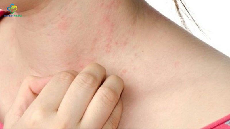 Mẩn ngứa, mụn nhọt là tình trạng da liễu phổ biến, có thể xuất hiện ở mọi lứa tuổi và gây ảnh hưởng đến thẩm mỹ, cuộc sống