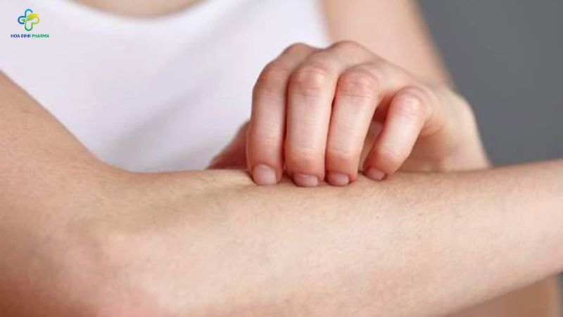 Khi da hoặc móng bị nhiễm nấm, vùng tổn thương thường có một số đặc điểm rất đặc trưng