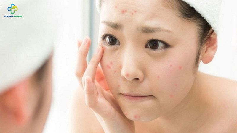Mẩn ngứa và mụn nhọt không chỉ là phản ứng ngoài da đơn thuần mà còn là dấu hiệu cho thấy cơ thể đang gặp vấn đề bên trong