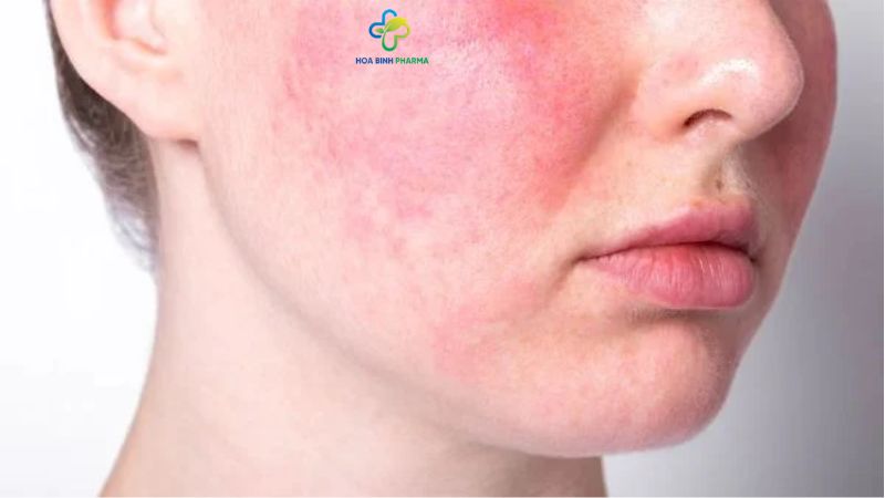 Khi da khô, lớp màng bảo vệ da bị suy yếu, dễ bị các chất gây kích ứng từ bên ngoài tấn công